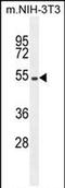 Eukaryotic Translation Initiation Factor 2B Subunit Delta antibody, PA5-71496, Invitrogen Antibodies, Western Blot image 