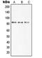 Solute Carrier Family 6 Member 15 antibody, LS-B13630, Lifespan Biosciences, Western Blot image 