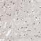 AF4/FMR2 Family Member 4 antibody, NBP1-89220, Novus Biologicals, Immunohistochemistry paraffin image 