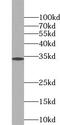 Proteoglycan 2, Pro Eosinophil Major Basic Protein antibody, FNab06770, FineTest, Western Blot image 