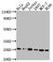 High Mobility Group Box 1 antibody, CSB-RA439052A0HU, Cusabio, Western Blot image 