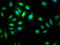 Adhesion Molecule With Ig Like Domain 2 antibody, LS-C677124, Lifespan Biosciences, Immunofluorescence image 