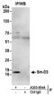 Small Nuclear Ribonucleoprotein D3 Polypeptide antibody, A303-954A, Bethyl Labs, Immunoprecipitation image 