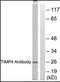 TIMP Metallopeptidase Inhibitor 4 antibody, orb95609, Biorbyt, Western Blot image 