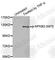 Nuclear Factor Kappa B Subunit 2 antibody, AP0419, ABclonal Technology, Western Blot image 