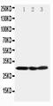 Catechol-O-Methyltransferase antibody, PA2203, Boster Biological Technology, Western Blot image 