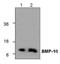 Bone morphogenetic protein 10 antibody, NBP1-50679, Novus Biologicals, Western Blot image 