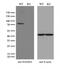 Hydroxyacyl-CoA Dehydrogenase Trifunctional Multienzyme Complex Subunit Alpha antibody, M03666, Boster Biological Technology, Western Blot image 