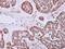Zinc finger protein 148 antibody, GTX104894, GeneTex, Immunohistochemistry paraffin image 