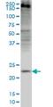 Crystallin Gamma D antibody, H00001421-M03, Novus Biologicals, Western Blot image 