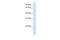 Chromosome 14 Open Reading Frame 180 antibody, PA5-69324, Invitrogen Antibodies, Western Blot image 