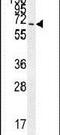 Cilia And Flagella Associated Protein 100 antibody, PA5-24123, Invitrogen Antibodies, Western Blot image 