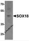SRY-Box 18 antibody, 7919, ProSci, Western Blot image 
