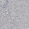 Mucin 16, Cell Surface Associated antibody, AMAb91056, Atlas Antibodies, Immunohistochemistry frozen image 