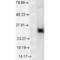 Heme Oxygenase 1 antibody, M00253-2, Boster Biological Technology, Western Blot image 
