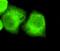 Nucleophosmin 1 antibody, STJ98470, St John