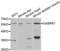Gamma-Aminobutyric Acid Type A Receptor Rho1 Subunit antibody, LS-C334256, Lifespan Biosciences, Western Blot image 