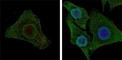 B-Raf Proto-Oncogene, Serine/Threonine Kinase antibody, NBP1-47433, Novus Biologicals, Immunocytochemistry image 