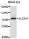 EAAT5 antibody, abx126563, Abbexa, Western Blot image 