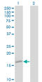 Transthyretin antibody, LS-C198383, Lifespan Biosciences, Western Blot image 