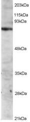 IL2 Inducible T Cell Kinase antibody, PA5-17957, Invitrogen Antibodies, Western Blot image 