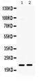 C-X-C Motif Chemokine Ligand 10 antibody, PA5-79104, Invitrogen Antibodies, Western Blot image 