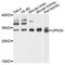 Uroplakin 3A antibody, abx135952, Abbexa, Western Blot image 