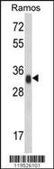 Major Histocompatibility Complex, Class II, DR Alpha antibody, MBS629152, MyBioSource, Western Blot image 