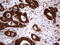 Galectin 3 antibody, LS-C796799, Lifespan Biosciences, Immunohistochemistry paraffin image 