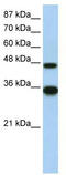 General Transcription Factor IIH Subunit 4 antibody, TA335198, Origene, Western Blot image 