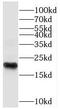 SPANX Family Member C antibody, FNab08151, FineTest, Western Blot image 