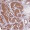 MIER Family Member 3 antibody, PA5-64251, Invitrogen Antibodies, Immunohistochemistry paraffin image 