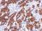 Gal-4 antibody, GTX114527, GeneTex, Immunohistochemistry paraffin image 