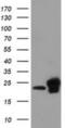 Zinc Ribbon Domain Containing 2 antibody, NBP2-03198, Novus Biologicals, Western Blot image 