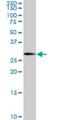 SRY-Box 15 antibody, H00006665-M02, Novus Biologicals, Western Blot image 