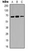 Interleukin 1 Receptor Associated Kinase 3 antibody, LS-C368869, Lifespan Biosciences, Western Blot image 