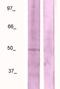 Jun Proto-Oncogene, AP-1 Transcription Factor Subunit antibody, TA354327, Origene, Western Blot image 