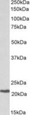 Core-Binding Factor Subunit Beta antibody, TA320210, Origene, Western Blot image 