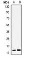 Pleckstrin Homology Like Domain Family A Member 2 antibody, LS-C667877, Lifespan Biosciences, Western Blot image 