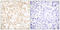 FOS Like 2, AP-1 Transcription Factor Subunit antibody, LS-C118453, Lifespan Biosciences, Immunohistochemistry paraffin image 