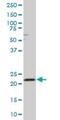 Ras-related protein Rab-4B antibody, H00005867-B01P, Novus Biologicals, Western Blot image 