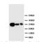 Suppressor Of Cytokine Signaling 2 antibody, orb27595, Biorbyt, Western Blot image 