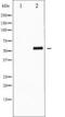 Forkhead Box O4 antibody, TA325482, Origene, Western Blot image 