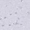 Potassium Voltage-Gated Channel Subfamily E Regulatory Subunit 2 antibody, NBP2-38653, Novus Biologicals, Immunohistochemistry paraffin image 