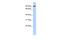 Transglutaminase 1 antibody, PA5-42057, Invitrogen Antibodies, Western Blot image 