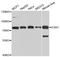 Estrogen Receptor 1 antibody, A0296, ABclonal Technology, Western Blot image 