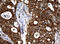 NME/NM23 Nucleoside Diphosphate Kinase 1 antibody, LS-C175578, Lifespan Biosciences, Immunohistochemistry paraffin image 