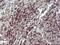 Interleukin 10 Receptor Subunit Alpha antibody, NBP2-46049, Novus Biologicals, Immunohistochemistry paraffin image 