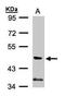 Phosphoinositide-3-Kinase Regulatory Subunit 3 antibody, PA5-21870, Invitrogen Antibodies, Western Blot image 