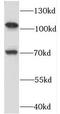 RNA Binding Motif Protein 15B antibody, FNab07164, FineTest, Western Blot image 